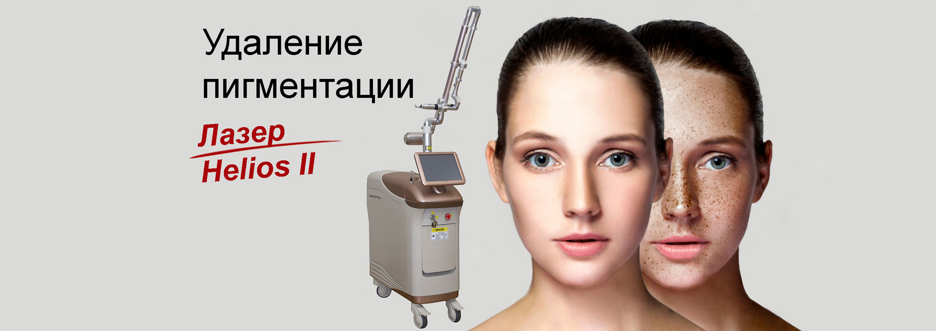 pigmetation-delete-laser-helios-2 pigmetation-delete-laser-helios-2