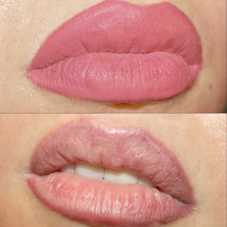 premanent-lips-koreanmed1