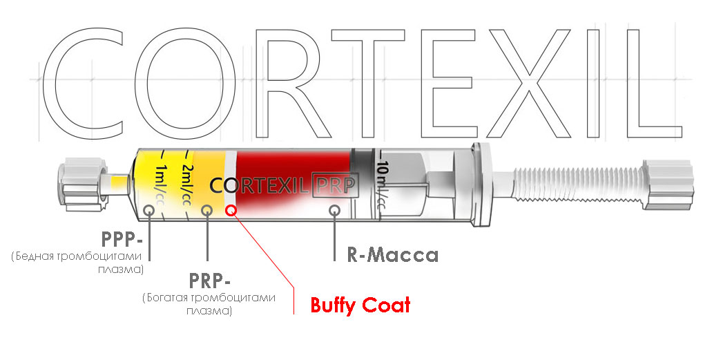 Cortexil-prp-image2