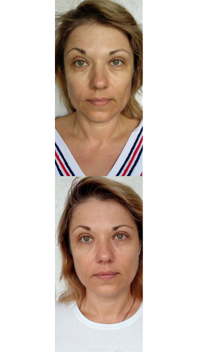 Korean_massage_face_koreanmed_almaty_3